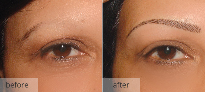 eyebrow enhancements - before and after