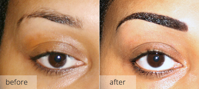 eyebrow enhancements - before & after 2