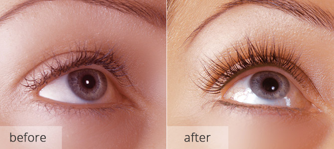 Cosmetic eyelash enhancements