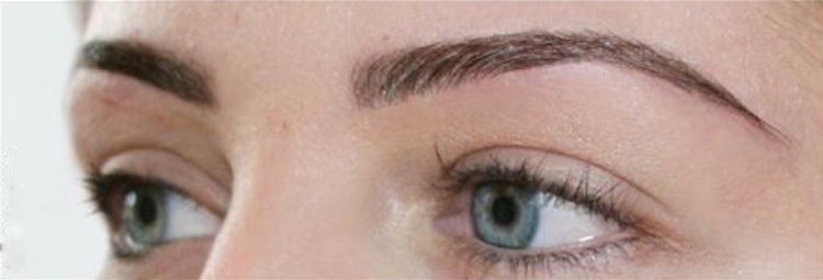 Highly Defined Brows treatment - after