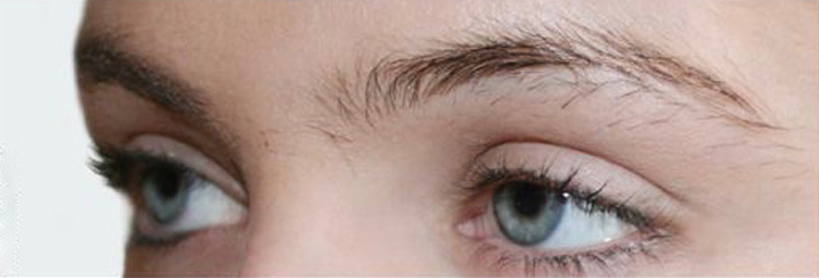 Highly Defined Brows treatment - before